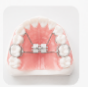 Orthodontic appliance